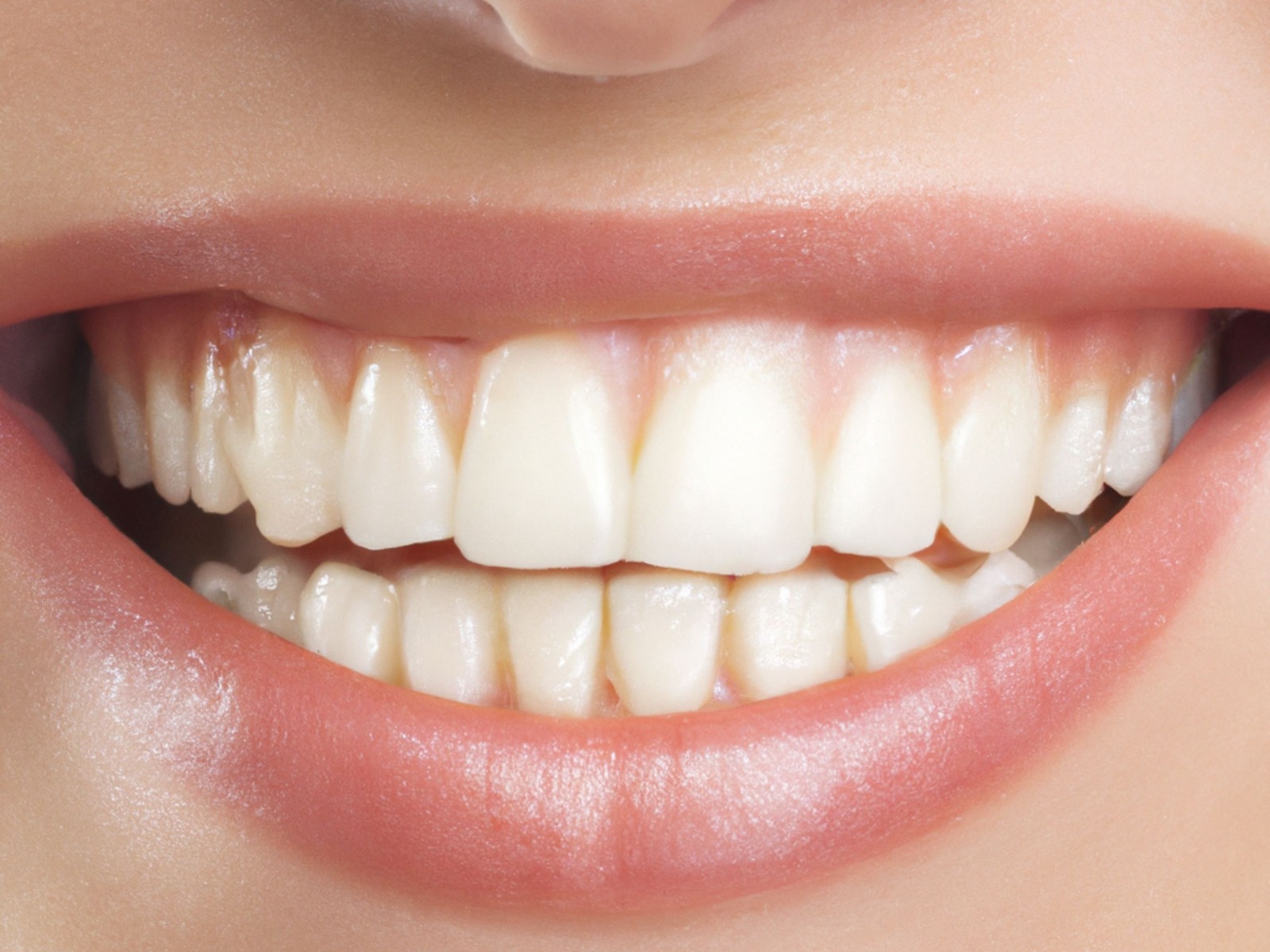 Patient with bright white smile after teeth whitening